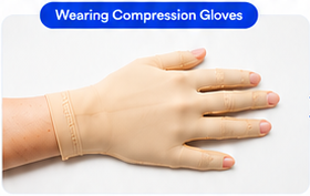 Patient wearing compression glove